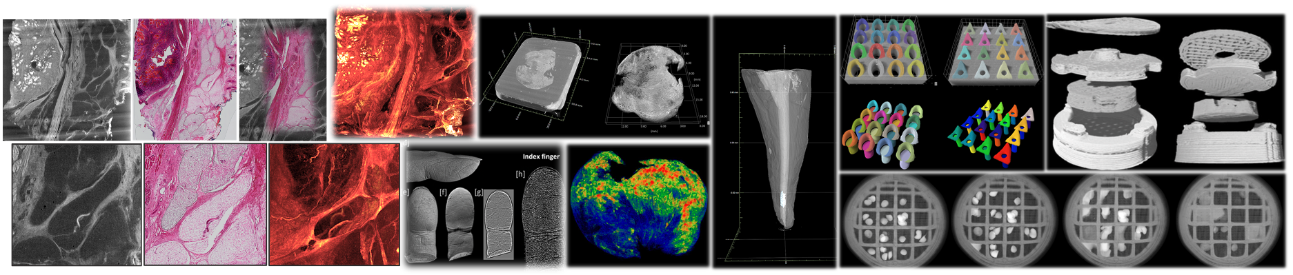 3D volume render of biological tissue